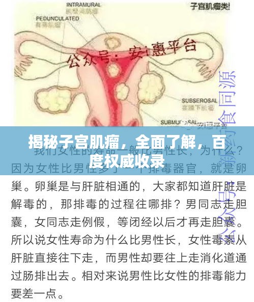 揭秘子宫肌瘤，全面了解，百度权威收录