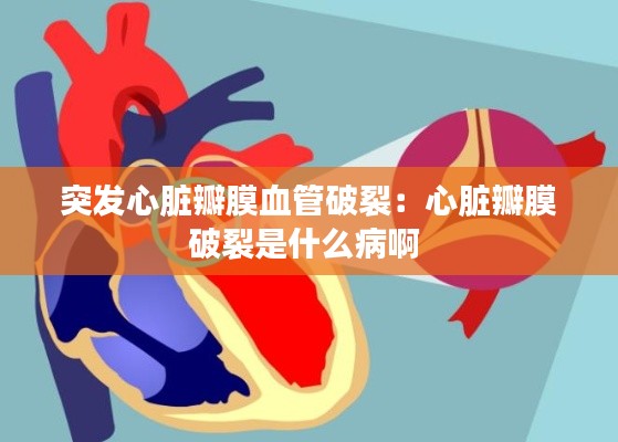 突发心脏瓣膜血管破裂：心脏瓣膜破裂是什么病啊 