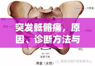 突发骶髂痛，原因、诊断方法与治疗策略